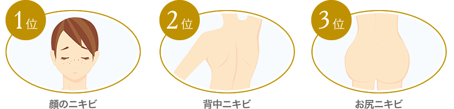 当院にご相談が多い部位